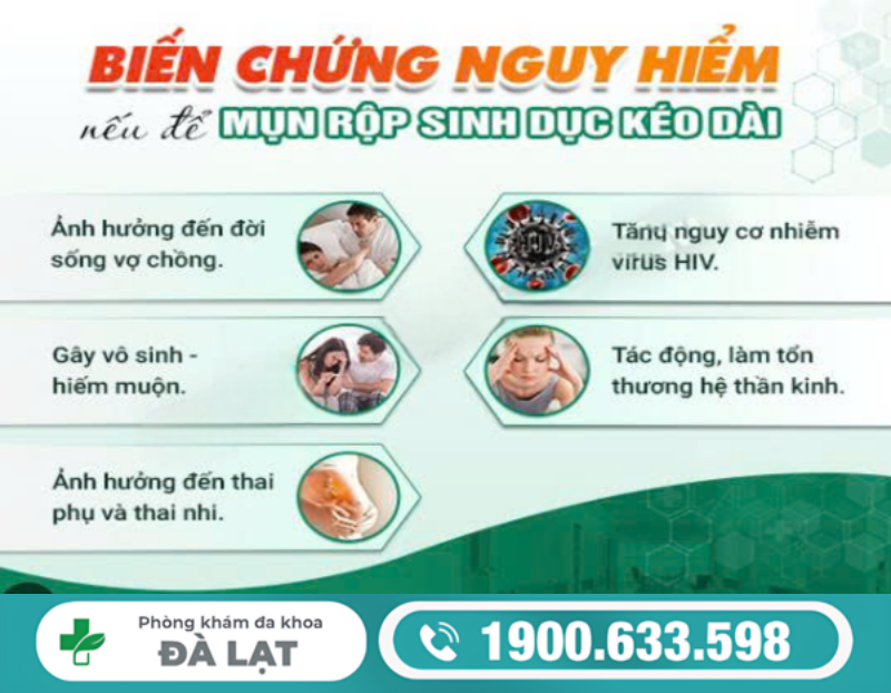 Hình ảnh minh họa